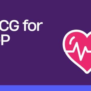 ECG